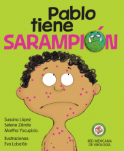 Sarampión 